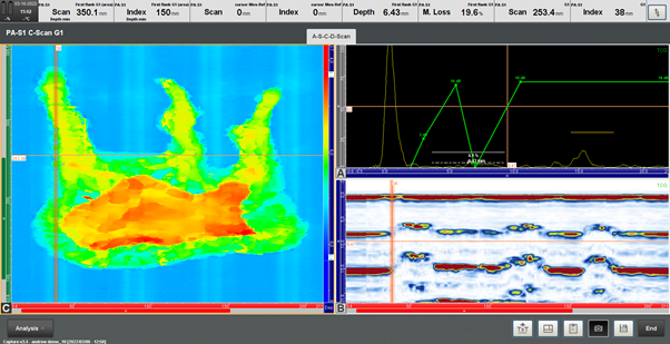 Lync Scanner What You May Not Know About the LYNCS™ Advanced Ultrasonic Scanner