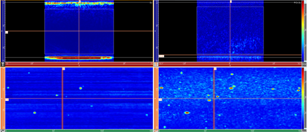 The Pros and Cons of Phase Coherence Imaging (PCI)