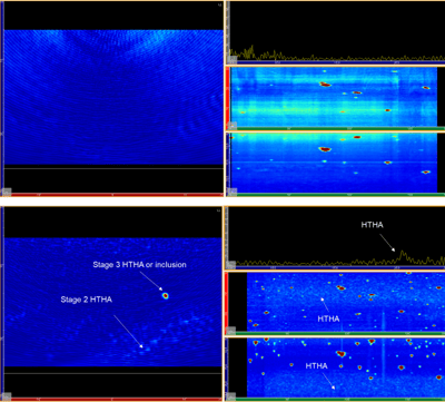 HTHA - Stage 3 or Inclusion